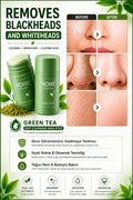 NOIRE PREMIUM Yeşil Çay Özlü Siyah Nokta ve Akne Maskesi & Green Tea Extract Acne and Pimple Mask - Siyah