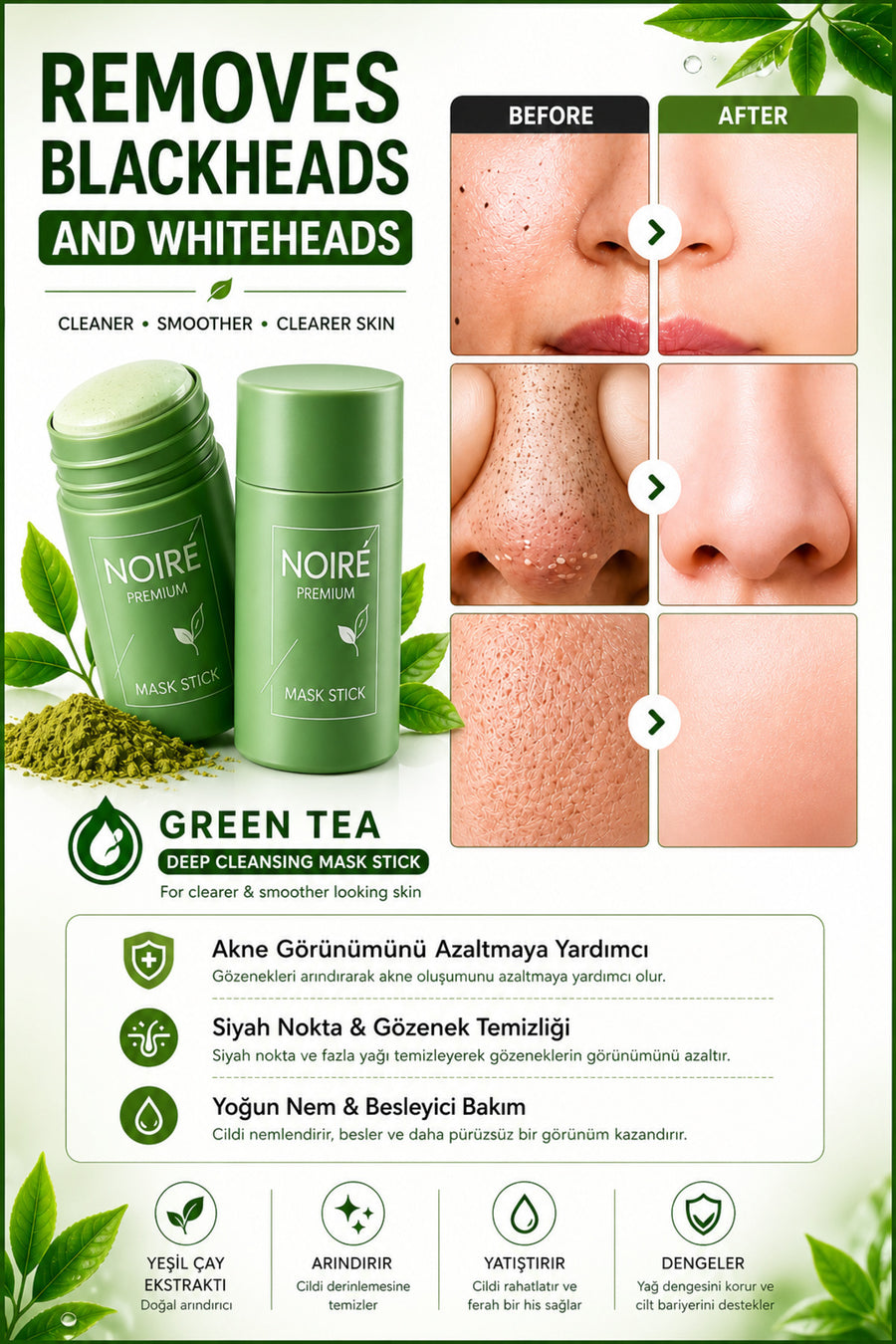 NOIRE PREMIUM Yeşil Çay Özlü Siyah Nokta ve Akne Maskesi & Green Tea Extract Acne and Pimple Mask - Siyah