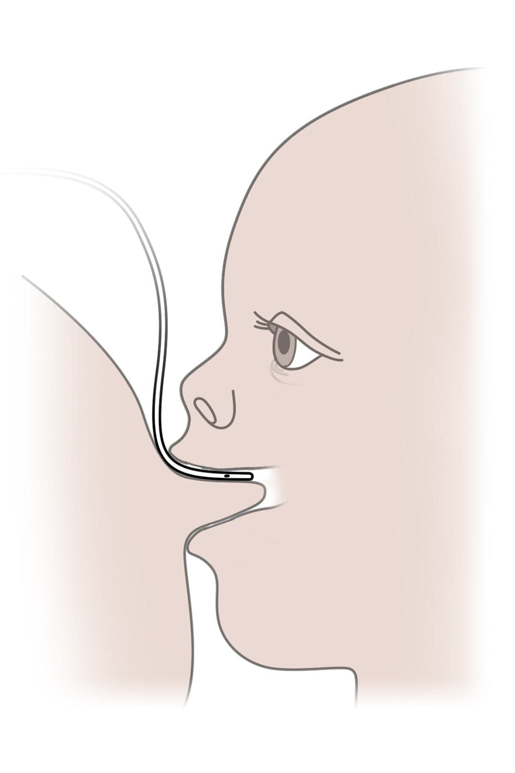Eday Emzirme Destek Sistemi Eds ml -ayd